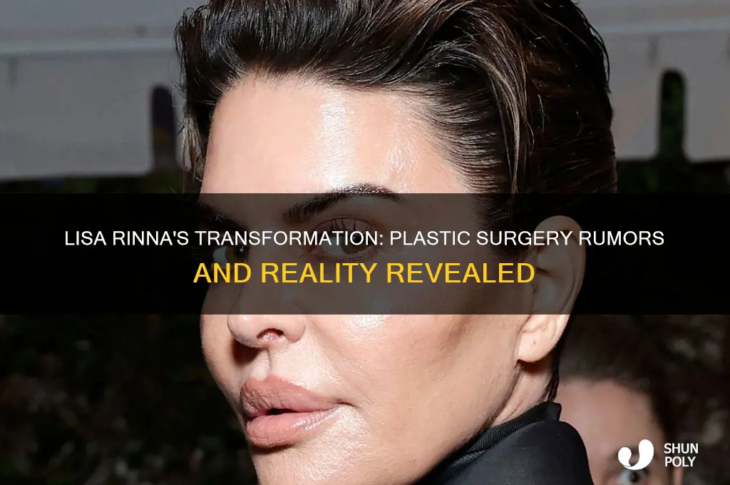 has lisa rinna had plastic surgery
