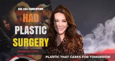 Lisa Vanderpump's Transformation: Plastic Surgery Rumors and Reality Revealed
