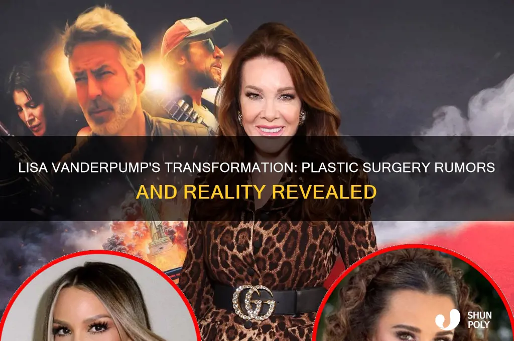 has lisa vanderpump had plastic surgery