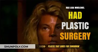Lisa Whelchel's Transformation: Plastic Surgery Rumors Explored