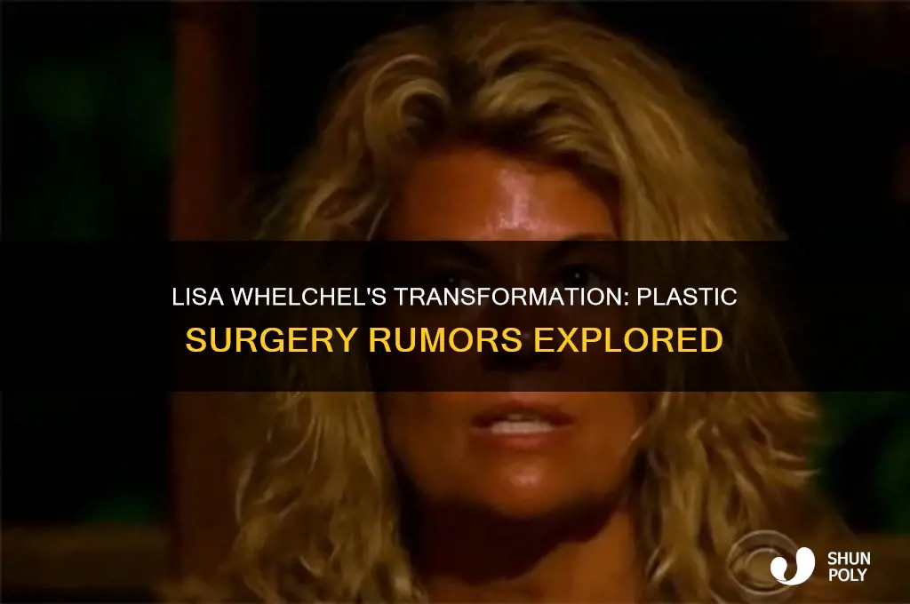 has lisa whelchel had plastic surgery