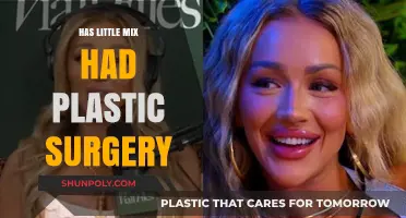 Little Mix Plastic Surgery: Unveiling the Truth Behind Their Transformation
