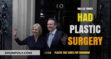 Has Liz Truss Had Plastic Surgery? Unveiling the Truth
