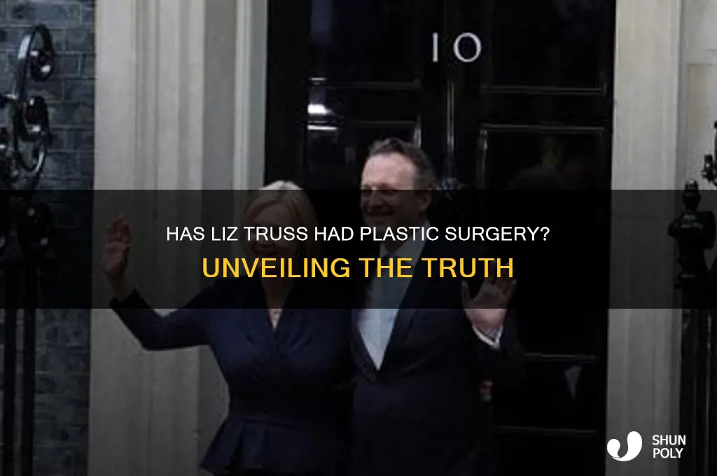 has liz truss had plastic surgery