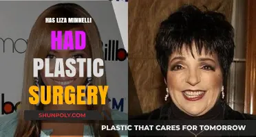 Liza Minnelli's Transformation: Plastic Surgery Speculations and Truths