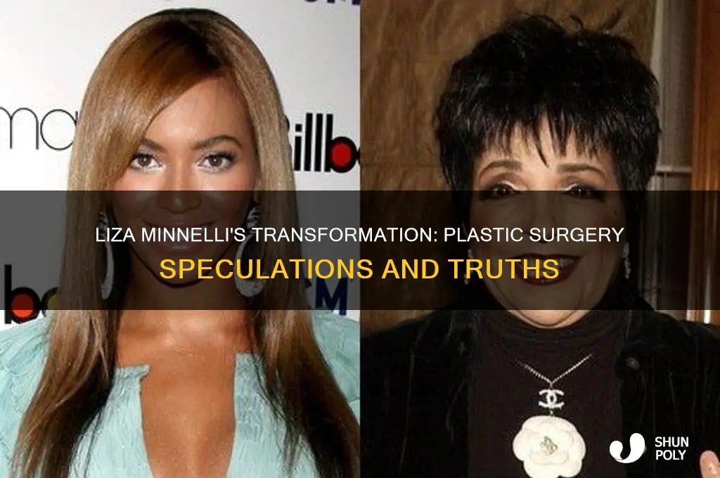 has liza minnelli had plastic surgery
