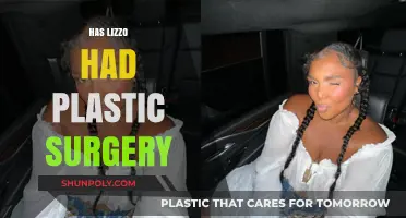 Lizzo's Transformation: Plastic Surgery Speculations and the Truth Behind Them