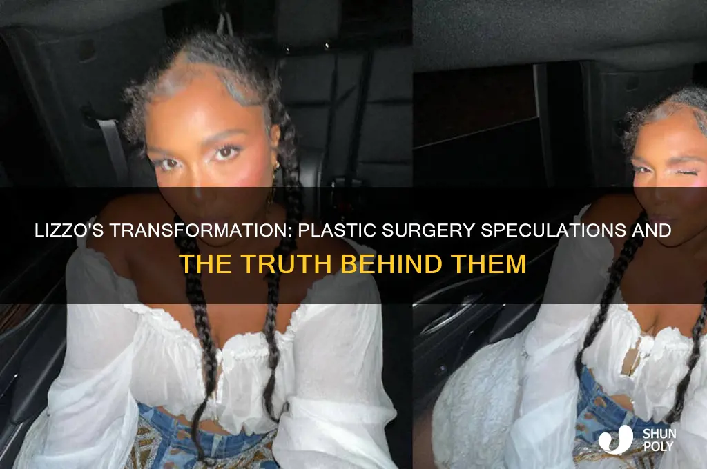 has lizzo had plastic surgery