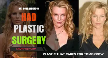 Loni Anderson's Transformation: Plastic Surgery Speculations and Truths Revealed