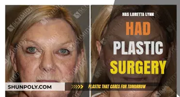 Loretta Lynn's Transformation: Plastic Surgery Speculations and Truths Revealed