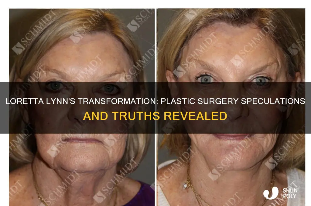 has loretta lynn had plastic surgery