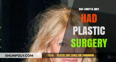 Loretta Swit's Transformation: Plastic Surgery Speculations and Truths