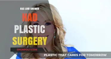 Lori Greiner's Transformation: Plastic Surgery Speculations and Facts Revealed