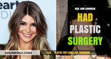 Lori Loughlin's Transformation: Plastic Surgery Rumors and Speculations