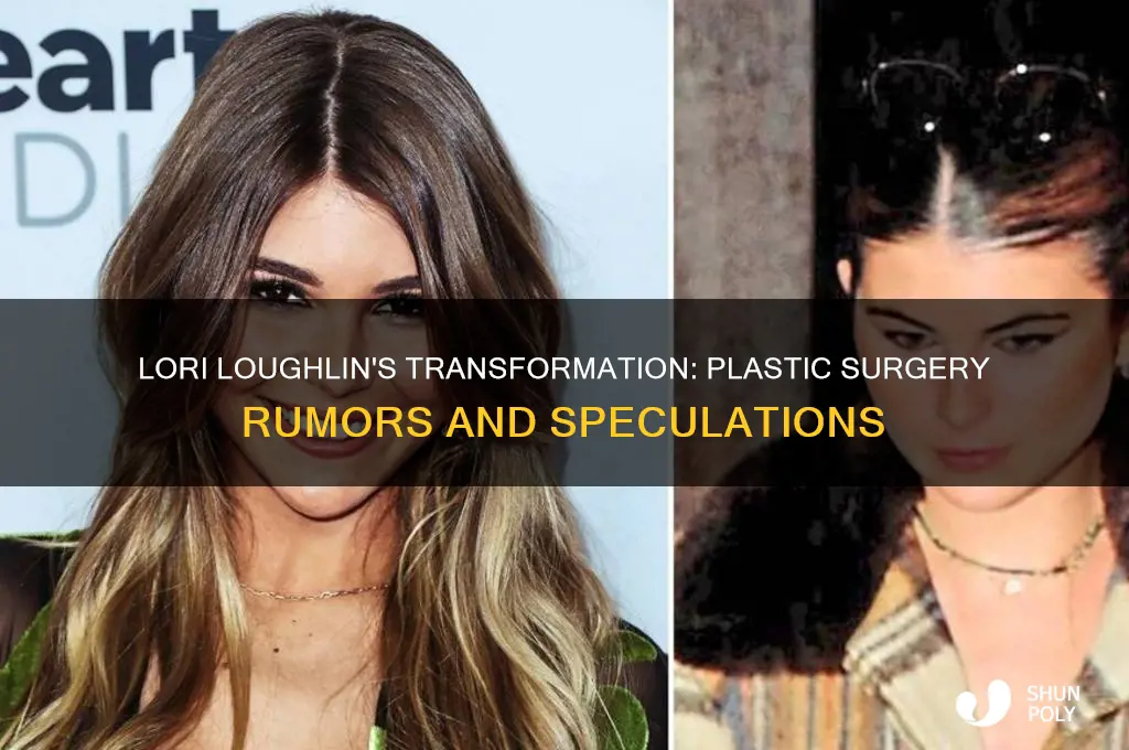 has lori loughlin had plastic surgery