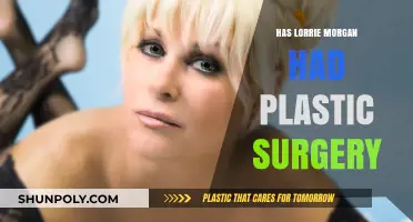 Lorrie Morgan's Transformation: Plastic Surgery Speculations and Truths Revealed
