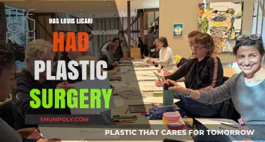 Louis Licari Plastic Surgery: Fact-Checking the Rumors and Speculations