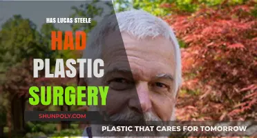 Has Lucas Steele Had Plastic Surgery? Unveiling the Truth
