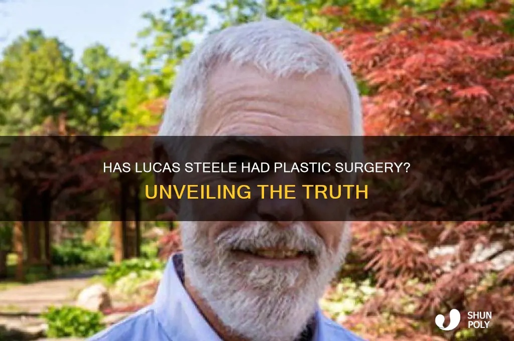 has lucas steele had plastic surgery