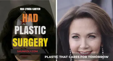 Lynda Carter's Ageless Beauty: Plastic Surgery Speculations Explored