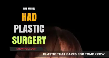 Has Mabel Had Plastic Surgery? Uncovering the Truth Behind Her Look