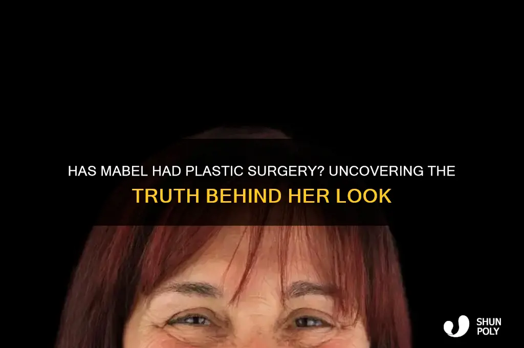 has mabel had plastic surgery