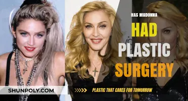 Madonna's Transformation: Unveiling the Truth About Her Plastic Surgery