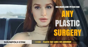 Madelaine Petsch Plastic Surgery: Fact-Checking Rumors and Speculations