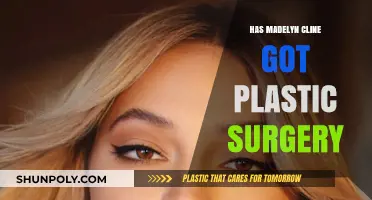 Madelyn Cline Plastic Surgery: Fact-Checking Rumors and Speculations
