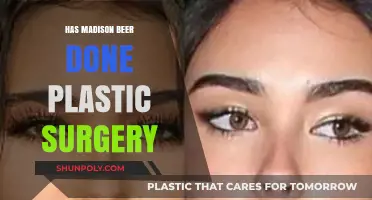 Madison Beer Plastic Surgery: Fact-Checking Rumors and Speculations