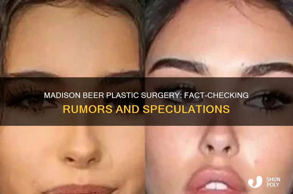 has madison beer done plastic surgery