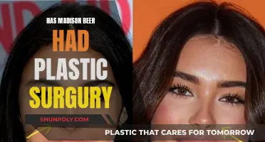 Madison Beer's Plastic Surgery: What's the Truth?