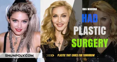 Madonna's Transformation: Unveiling the Truth About Her Plastic Surgery