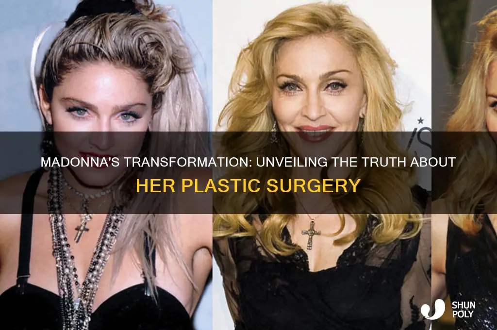 has madona had plastic surgery