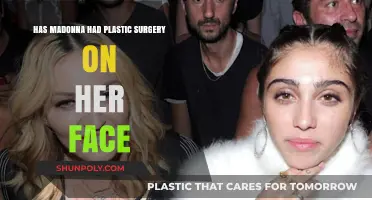 Madonna's Face: Natural Aging or Plastic Surgery Transformation?