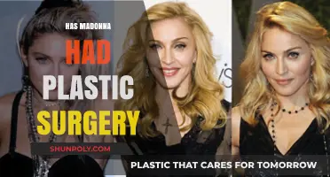 Madonna's Transformation: Unveiling the Truth About Her Plastic Surgery