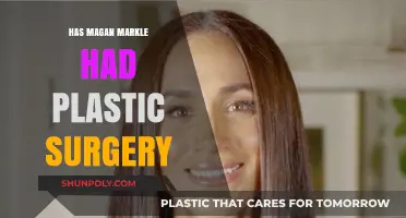 Meghan Markle's Transformation: Plastic Surgery Rumors and Reality Revealed