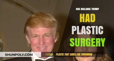Melania Trump's Transformation: Plastic Surgery Speculations and Facts Revealed