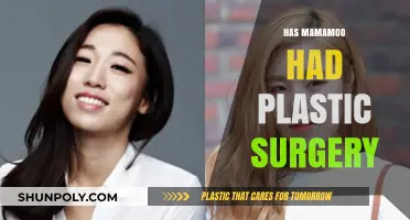 Mamamoo Plastic Surgery: Unveiling the Truth Behind Their Transformation