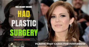 Mandy Moore's Transformation: Plastic Surgery Rumors Explored and Debunked