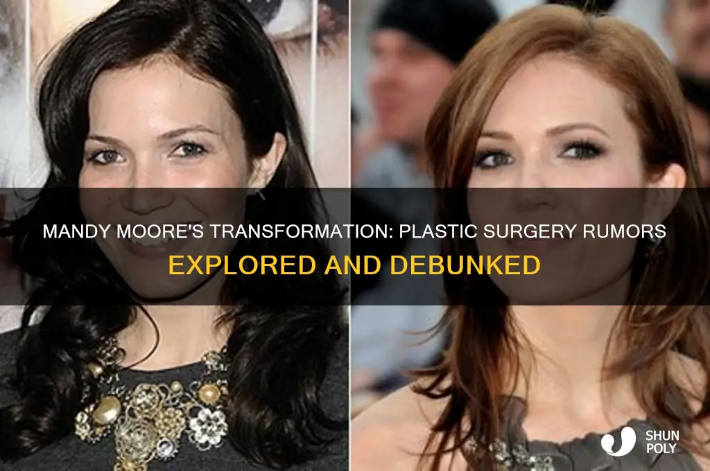 has mandy moore had plastic surgery