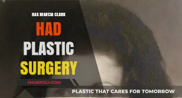 Marcia Clark's Transformation: Plastic Surgery Rumors and Reality Revealed