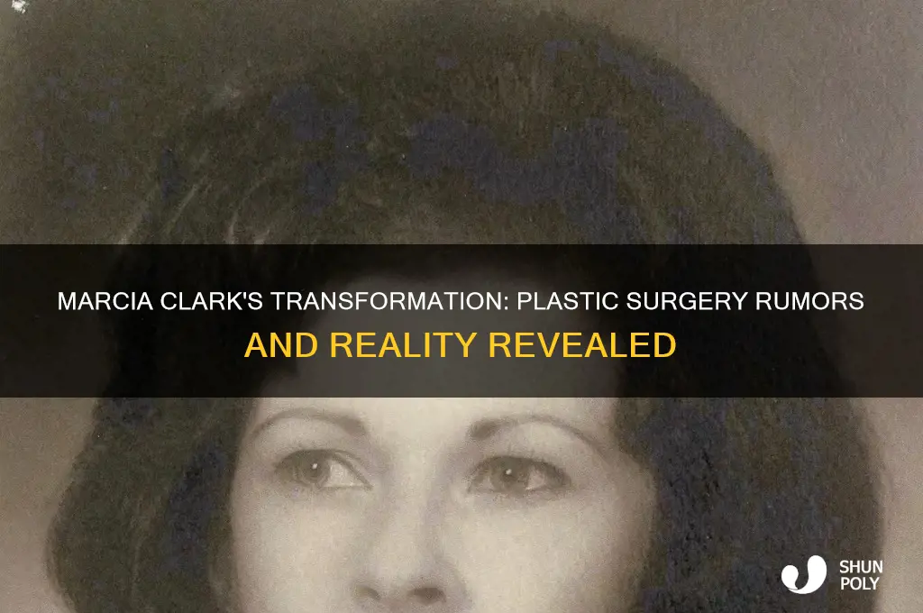 has marcia clark had plastic surgery