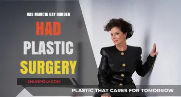 Marcia Gay Harden's Transformation: Plastic Surgery Speculations Explored