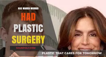 Maren Morris Plastic Surgery: Fact-Checking the Rumors and Speculations