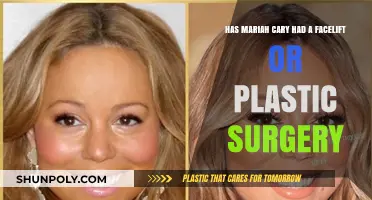 Mariah Carey's Transformation: Facelift or Natural Aging Gracefully?