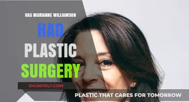 Marianne Williamson's Transformation: Plastic Surgery Speculations and Truths