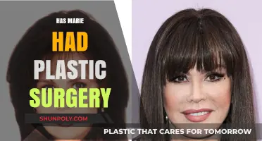 Marie's Transformation: Unveiling the Truth About Her Plastic Surgery Rumors