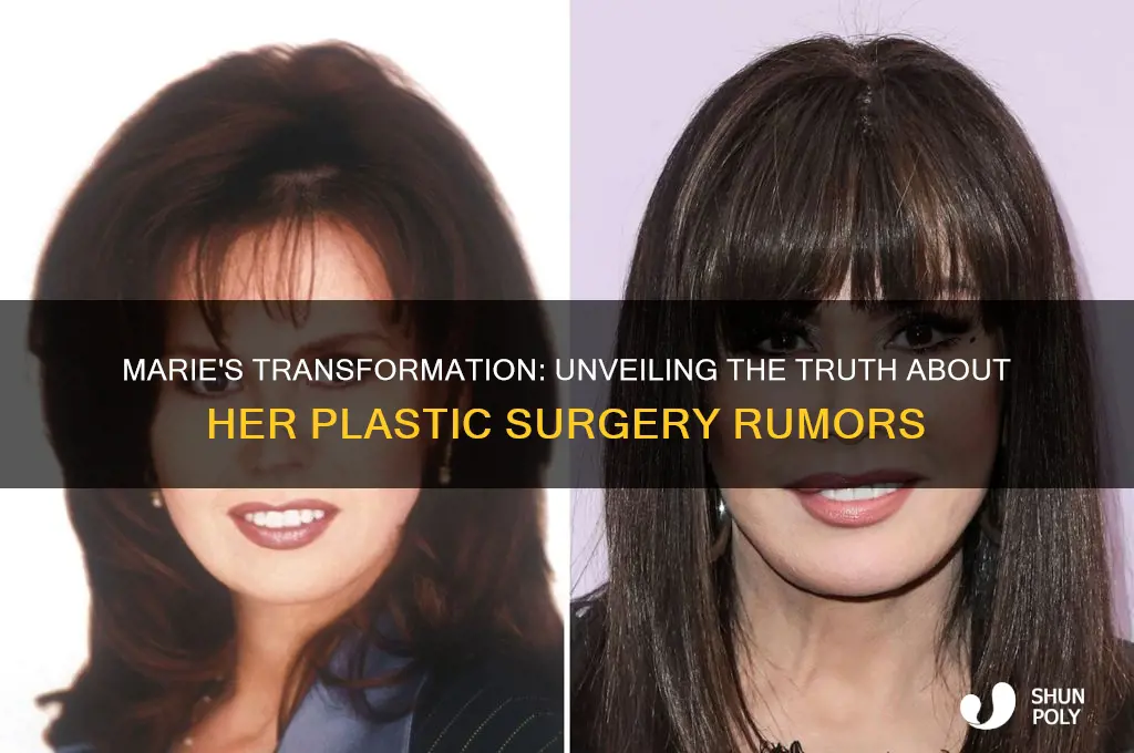 has marie had plastic surgery