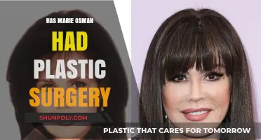 Marie Osman's Transformation: Plastic Surgery Rumors Explored and Analyzed